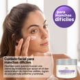 thumbnail image 2 of Crema despigmentante Vitalis para manchas melasma acné 50g, 2 of 11