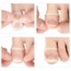 thumbnail image 4 of Herramienta De Silicona Para Uñas Encarnadas, Reduce La Hinchazón, 10 Unidades De Anillo Corrector De Uñas Encarnadas Transparente Para El Cuidado De Las Uñas, 4 of 7