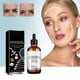 thumbnail image 1 of Aceite lifting facial rápido Aceite reafirmante facial Aceite reafirmante facial Aceite antiarrugas Aceite lifting facial 30 ml Aceites esenciales faciales, 1 of 9