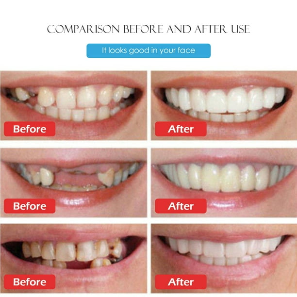 Carillas dentales de silicona simuladas Carillas dentales flexibles de simulación de sonrisa Cubierta cosmética para dientes Aparatos blanqueadores