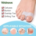 thumbnail image 3 of Pack of 12 Bunion Corrector, Toe Separators with 2 Loops, Big Toe Spacer Suitable for Bunion and Overlap Toe, 3 of 7