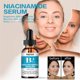 thumbnail image 4 of Esencia humectante Esencia facial de niacinamida para pieles secas, opacas y ásperas Hidratante facial Blanqueamiento de la piel, 4 of 6