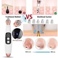 thumbnail image 4 of Graflsoa Electric Blackhead Remover & Pore Cleanser with 6 Interchangeable Heads for Deep Facial Cleaning, Suitable for Dry, Dull, and Aging Skin, Adjustable Suction Levels, White ABS Design, L1915, 4 of 6