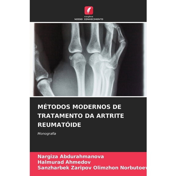 Métodos Modernos de Tratamento Da Artrite Reumatóide, (Paperback)