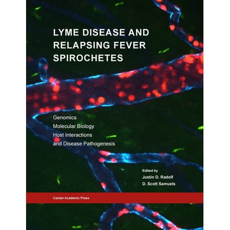 UPC: 9781913652616 | Lyme Disease and Relapsing Fever Spirochetes: Genomics  Molecular Biology  Host Interactions and Disease Pathogenesis (Paperback)