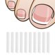 thumbnail image 2 of Tiras correctoras de uñas encarnadas para pies curvos, 2 of 5