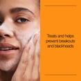 thumbnail image 2 of Neutrogena Oil-Free Acne Face Wash, Salicylic Acid Facial Cleanser & Acne Treatment, 9.1 fl oz, 2 of 8