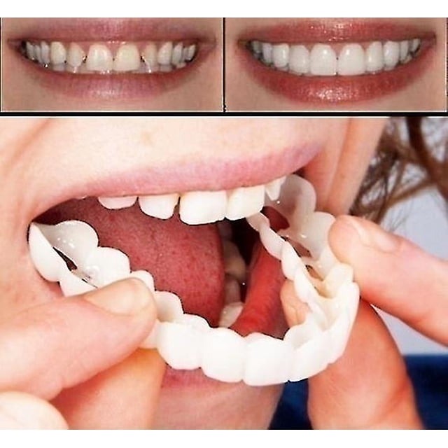 Un par de dentadura superior e inferior de alta calidad, sonrisa instantánea, ajuste cómodo, dientes cosméticos flexibles, dentadura postiza, chapa cosmética superior Sincero Hogar
