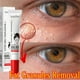 thumbnail image 2 of Crema para Ojos eliminadora de gránulos de grasa, antihinchazón, antiinflamatoria, crema firme, Reduce las ojeras, desvanece las líneas finas, barrera de reparación Sk, 2 of 5