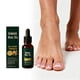 thumbnail image 1 of Pisexur Belleza Maquillaje Aceite de jengibre para uñas: para el cuidado de manos y pies. Repara las uñas dañadas, las fortalece y las protege. 30 ml.para mujeres y hombres, 1 of 9