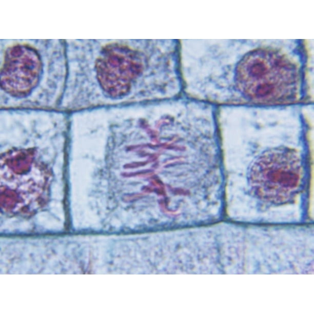 Metaphase Stage of Onion Mitosis (Allium) Print Wall Art