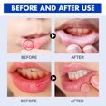 thumbnail image 3 of Tratamientos para el alivio del dolor de dientes Spray Limpiador de Periodontitis de 30ml, cura para el dolor de muelas, elimina el cuidado del dolor de la Periodontitis y las aftas, 3 of 5