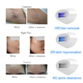 thumbnail image 2 of Depiladora láser IPL para mujer, máquina de depilación permanente Facial y corporal, dispositivo de depilación láser para Bikini, fotodepiladora para uso doméstico, 2 of 5