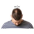 thumbnail image 2 of CORPORE SANO HAIR LOSS TONIC TREATMENT with Wheat,Soy,Ginseng and Hops. +82% Efficiency Tested. Hair Renewal- Thickening-Strengthening and Nourishing - 150 ml., 2 of 6