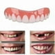 thumbnail image 1 of 2 Sets Of Dentures, Upper And Lower Jaw Dentures, Natural And Comfortable, Protect The Teeth, And Regain A Confident Smile, 1 of 3
