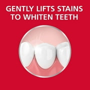 Paradontax Complete Protection Teeth Whitening Toothpaste for Bleeding Gums, 3.4 oz, 3 Pack