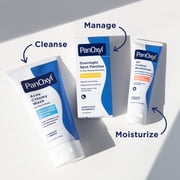 PanOxyl 4% Benzoyl Peroxide Acne Creamy Wash, Clear Acne, 6.0 Oz