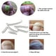 thumbnail image 5 of 12 Unids Incrustado Corrección Dedo Del Pie De Uñas Corrector De Uñas Dedo Del Pie Tratamiento Co MABOTO Corrección de uñas, 5 of 7