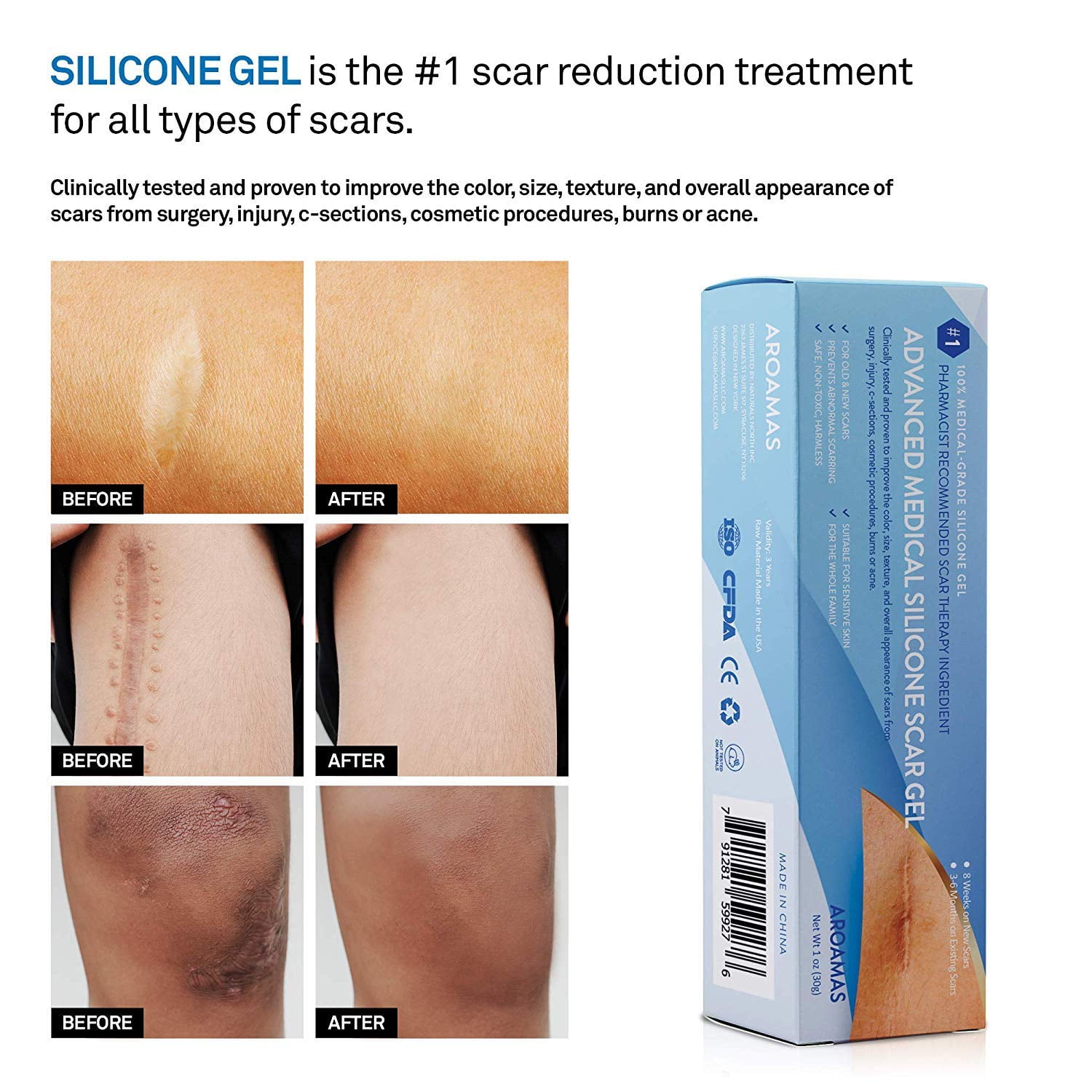 silicone scar cream for stretch marks