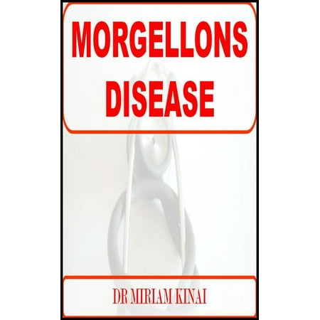 Morgellons Disease - eBook
