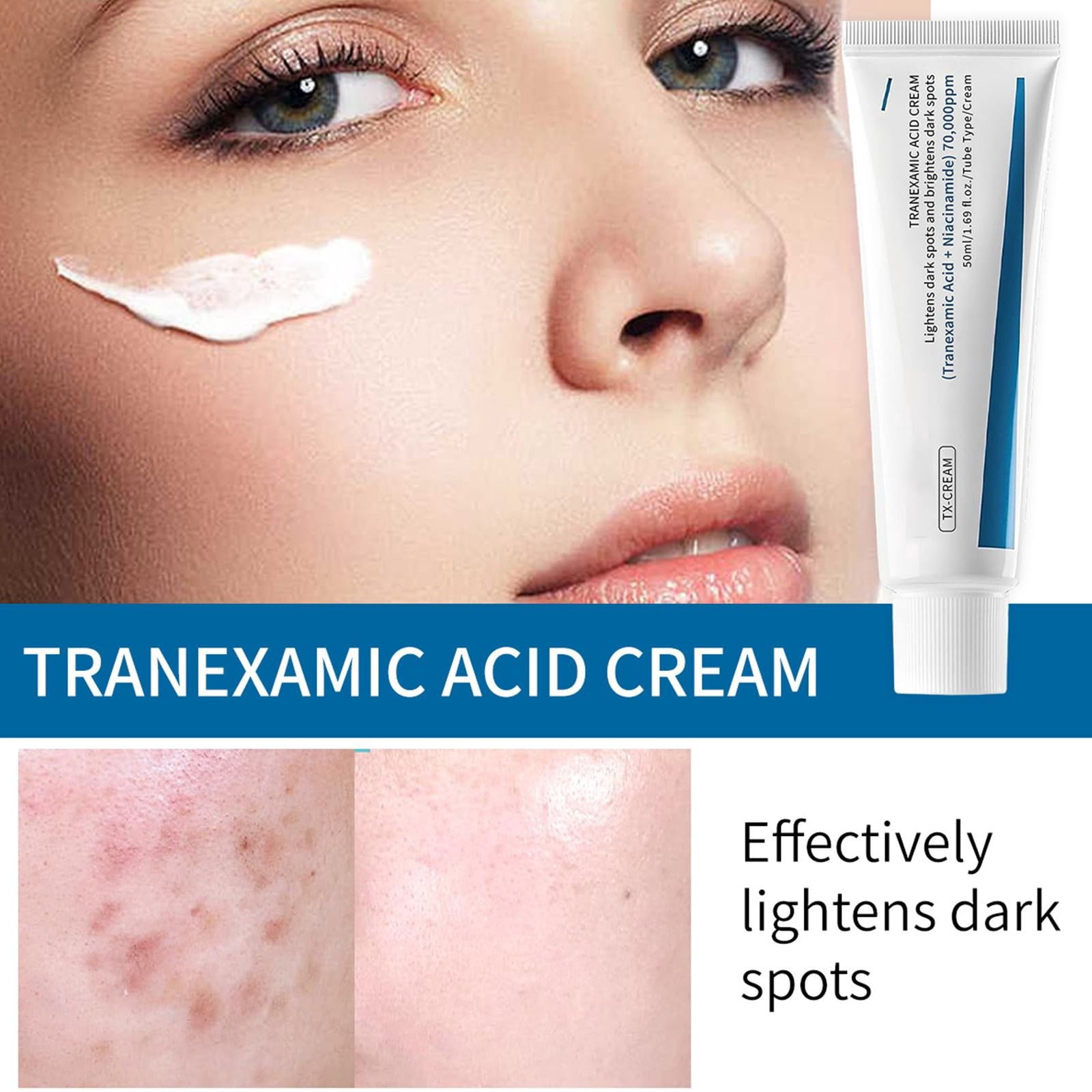 Tranexamic Acid Cream, Cream for skin Freckles, Blemishes, anti