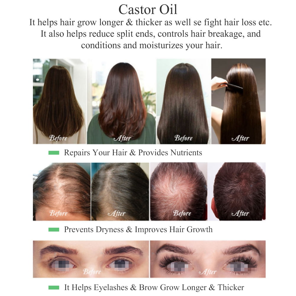 How to Use Castor Oil for Hair Growth, According to a Dermatologist –  SheKnows