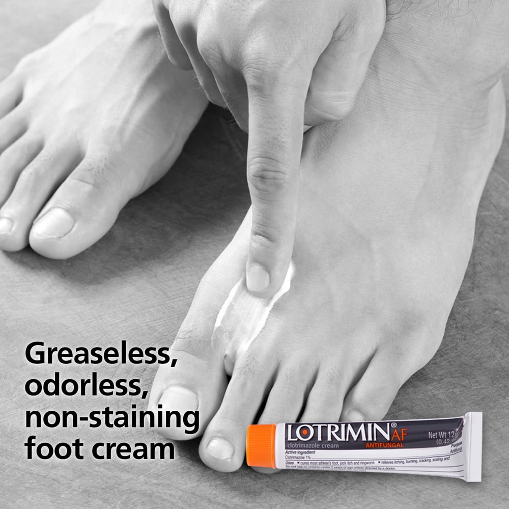 Lotrimin AF for Athlete's Foot Antifungal 1% Clotrimazole Cream, 0.85 oz