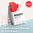 thumbnail image 2 of Hero Cosmetics Mighty Patch Original – Hydrocolloid Acne Patch, Overnight Acne Blemish & Zit Stickers for Sensitive Skin, 60ct, 2 of 6