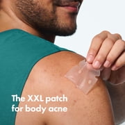 رقعة Mighty Patch Body من Hero Cosmetics، رقعة هيدروكولويد لعلاج حب الشباب في الجسم لمناطق ظهور حب الشباب الكبيرة، 4 قطع
