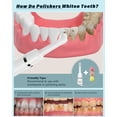 thumbnail image 2 of Pulidor de dientes Smile-Aid recargable con 3 pastas y 5 cabezales, 2 of 8