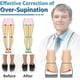 thumbnail image 5 of Elevador de talón ortopédico ajustable de 2/3 capas para corrección de supinación y pronación. Inserciones de cuña para el talón medial y lateral para dolor de rodilla y piernas arqueadas s2024, 5 of 5