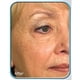 thumbnail image 4 of La terapia con células madre de Biologic Solutions reduce las arrugas Age Signs Topical Cream (Set Of 2 Frascos) Biologic Solutions E74530 P2, 4 of 5