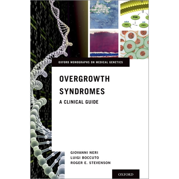Oxford Monographs on Medical Genetics Overgrowth Syndromes: A Clinical Guide, (Hardcover)