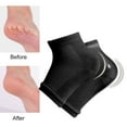 thumbnail image 3 of CNKOO 1 Set Gel Heel Socks Woolen Toeless Comfortable Open Toe Silicone Beauty Hosiery Spa Experience Adjustable Ankle Kit, 3 of 8