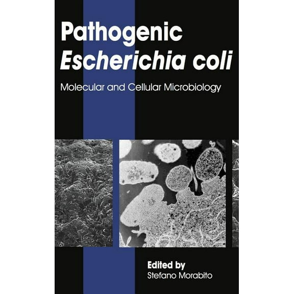 Pathogenic Escherichia coli: Molecular and Cellular Microbiology, (Hardcover)