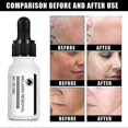 thumbnail image 4 of Lightens Spots Facial Skin Removes Melanin Lightens Fre, 4 of 5