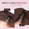 thumbnail image 4 of Champú Jengibre Hidratante Nutritivo Anticaspa para Cabello Graso | Control de aceite de limpieza profunda | Reparación Hidratante | Sin sulfatos | Fórmula refrescante | 400ml | Todo tipo de cabello, 4 of 5