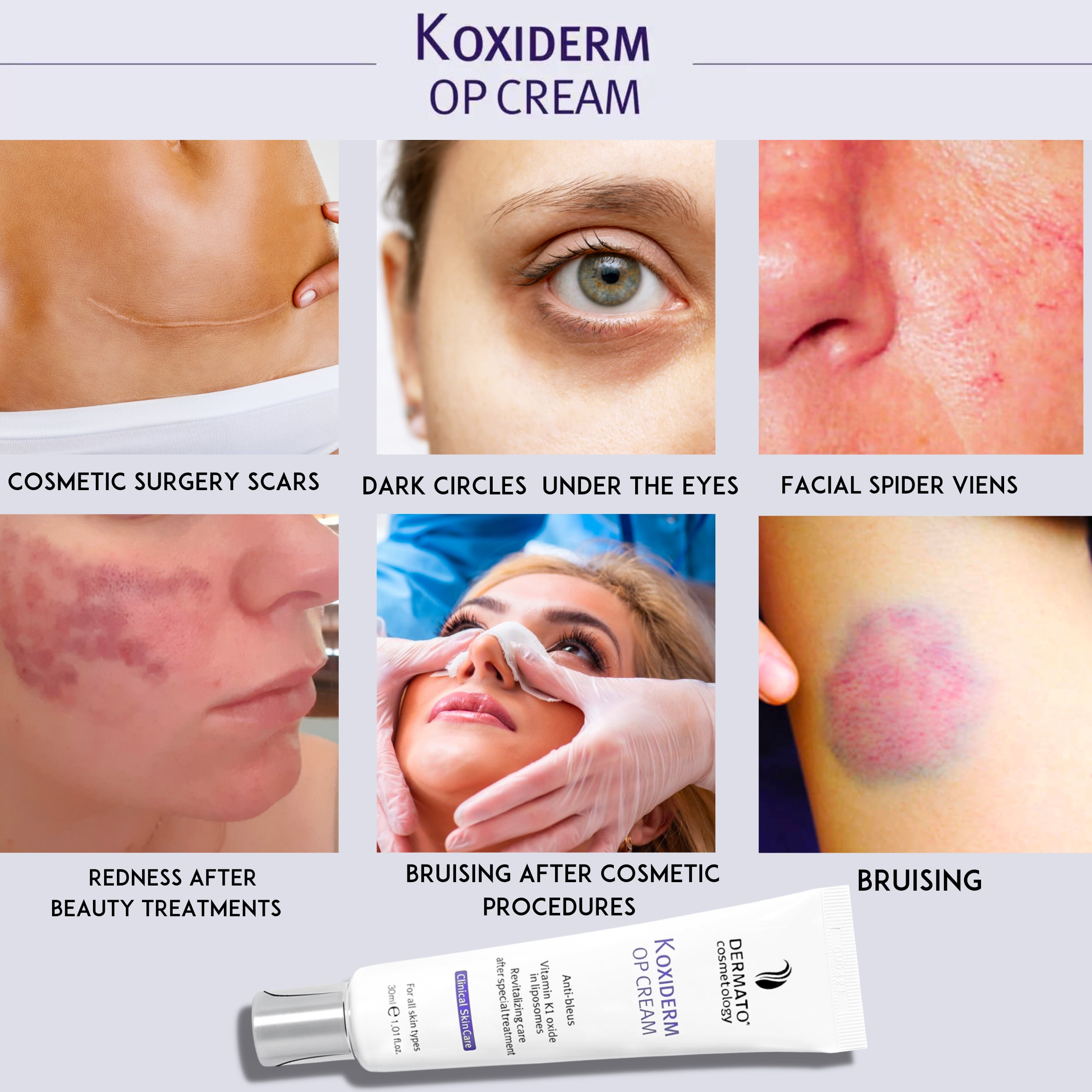 Vitamin K1 Oxiderm Cream Minimizing Appearance of Old and New Scars