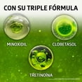 thumbnail image 4 of SISTEMA GB - Soluci&oacute;n contra la alopecia. Ingredientes activos que combaten la calvicie bloqueando la enzima que tira el cabello. Frasco y atomizador con 60ml, 4 of 9