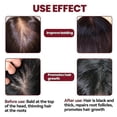 thumbnail image 5 of Hair Growth Treatment Care Regrowth For Women Prevents Hair Loss Scalp Foam, 5 of 5