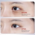 thumbnail image 5 of QunYou Caffeine Eye Cream Lightens Puffiness Under Dark Circles and Reduces Fines Line Spots By 15g, 5 of 9
