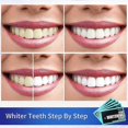 thumbnail image 3 of ExquisiteWhitening Strips (14 Pieces), Teeth Whitening Strips, Professional Teeth Whitening Strips, Quick Removal of All Teeth Stains, Black, 3 of 5