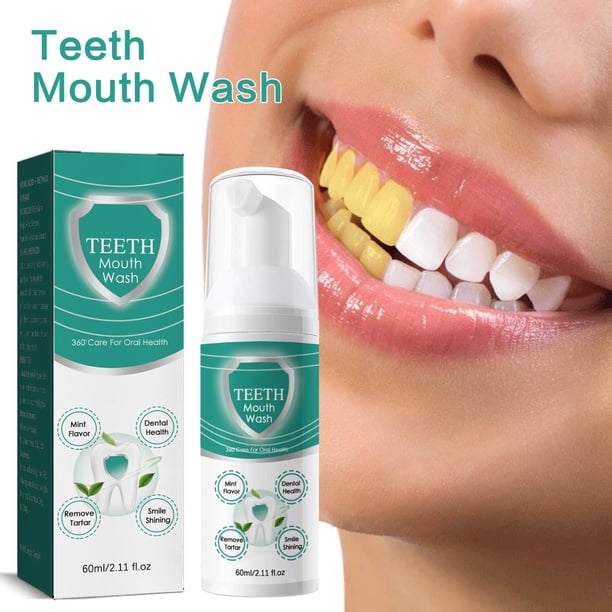Fiudx Enjuague Blanqueador Bucal, Gel Quitamanchas para Cuidado Bucal, Pasta Dental Refresco, Solución de Higiene Diaria, Apto para Todas Las Edades, Formato de Viaje de 60 Ml