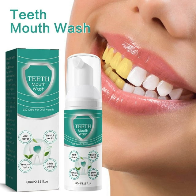 Fiudx Solución Blanqueadora de Dientes, Potente Enjuague Bucal para Eliminar Manchas, Refrescante Bucal para Una Frescura Duradera, Prevención de Caries para Una Buena Salud Bucal, Cuidado Bucal Diar
