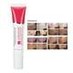thumbnail image 5 of Crema Para Eliminar Cicatrices, Reparar Cicatrices Regain Beauty Gel Reparador Corporal Suave Para Reparar Cicatrices De Quemaduras ANGGREK Oro, 5 of 8