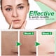thumbnail image 2 of 3 Uds 10ml Suero Facial Que Reduce Los Poros Suero Facial Hidratante Rejuvenecedor ANGGREK Shrinking Pores Facial Serum, 2 of 8