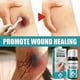 thumbnail image 3 of South Moon Waterproof Liquid Band-Aid Wound Surface Protection Rapid Film Forming Transparent Liquid Adhesive Bandage - 10Ml |, 3 of 4