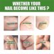 thumbnail image 2 of South Moon Nail Care Roller Balls - Nourishing Massage For Stronger, Faster-growing Nails With 7-day Nail Growth Formula, 2 of 5