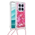 thumbnail image 1 of Funda FOXDOCK para Xiaomi Redmi Note 14 Pro 5G con Cuerda Ajustable, Brillo Líquido, Protección Antigolpes y Lente – Ideal para Regalo, 1 of 6
