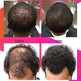thumbnail image 3 of Aceite para el cabello nutritivo reparador para cabello seco y dañado, duradero, restauración rápida, suavizante, cuidado del cuero cabelludo y cabello encrespado, aceites esenciales, 5 unidades, 3 of 5